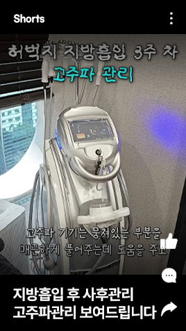 지방흡입 후 사후관리 고주파관리 보여드립니다
