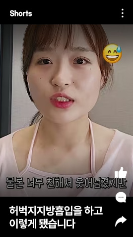 허벅지지방