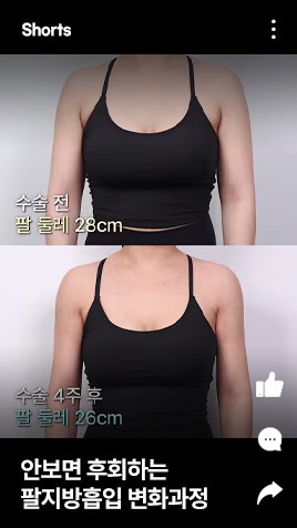 안보면 후회하는 팔지방흡입 변화과정
