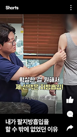 내가 팔지방흡입을 할 수 밖에 없었던 이유