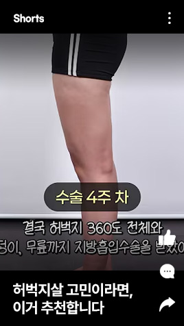 허벅지살 고민이라면, 이거 추천합니다