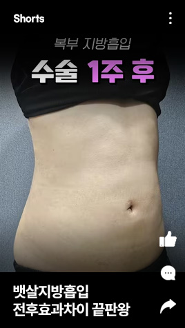 뱃살지방