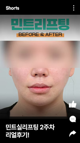 민트실리프팅 2주