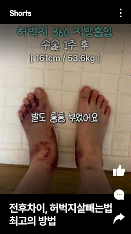 전후차이, 허벅지살빼는법! 최고의 방법