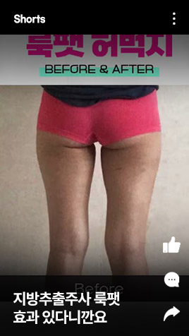 지방추출주사 룩팻 효과 있다니깐요