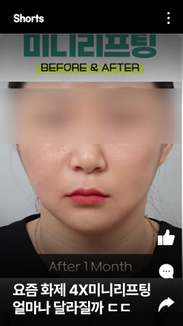 요즘 화제 4X미니리프팅 얼마나 달라질까 ㄷㄷ