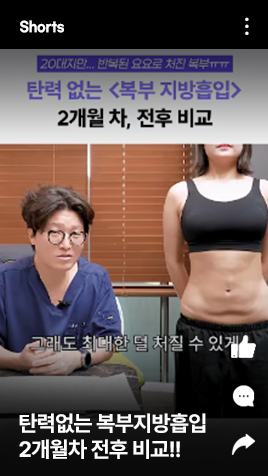 20대, 탄력없는 복부지방흡입 2개월차 전후 비교!! 이렇게 달라집니다