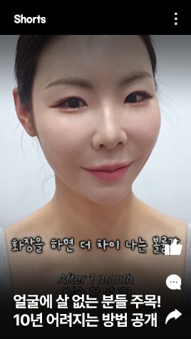 얼굴에 살 없는 분들 주목! 10년 어려지는 방법 공개