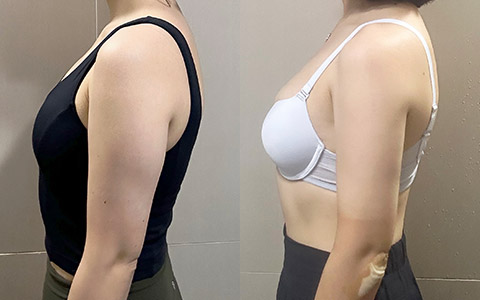 룩팻 팔 밖 이미지