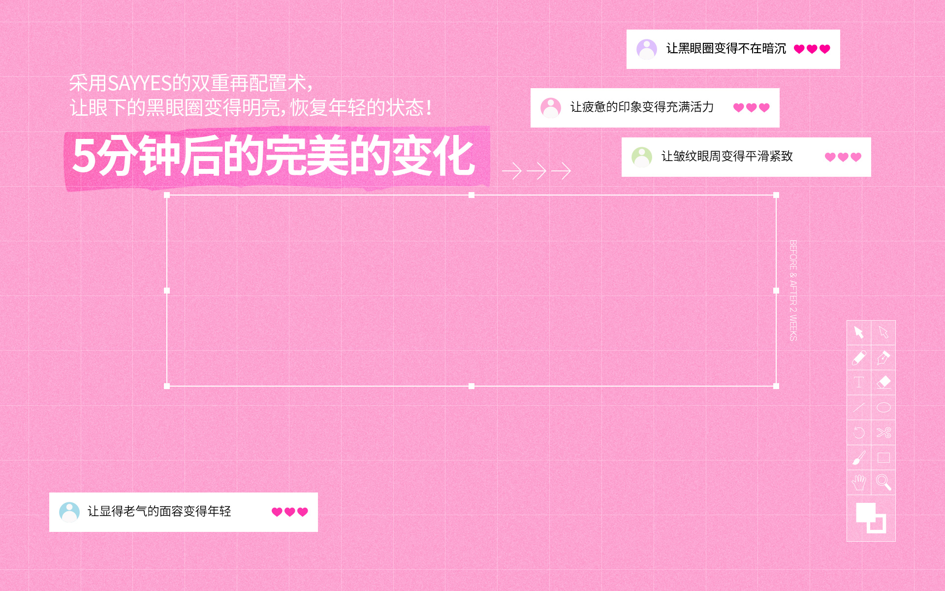 采用Sayyes的双重再配置术, 让眼下的黑眼圈变得明亮, 恢复年轻的状态! 5分钟后的完美的变化
