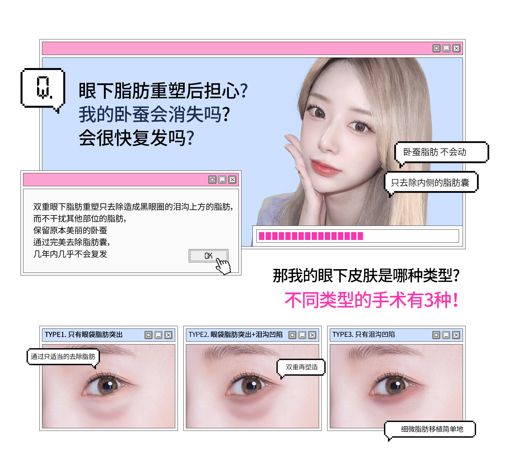 双重眼下脂肪重塑只去除造成黑眼圈的泪沟上方的脂肪, 而不干扰其他部位的脂肪, 保留原本美丽的卧蚕通过完美去除脂肪囊, 几年内几乎不会复发.