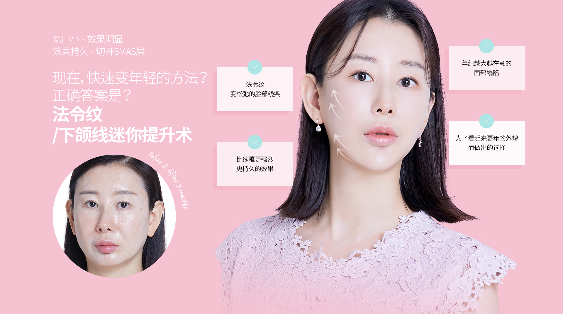 切口小 · 效果明显 效果持久 · 切开SMAS层现在, 快速变年轻的方法? 正确答案是?