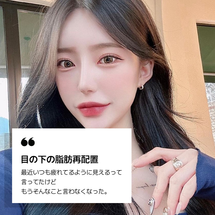 目の下の脂肪再配置 REVIEW