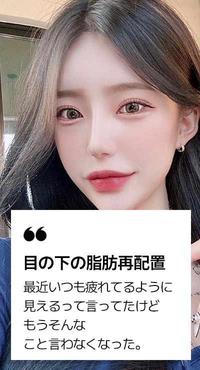 目の下の脂肪再配置 REVIEW