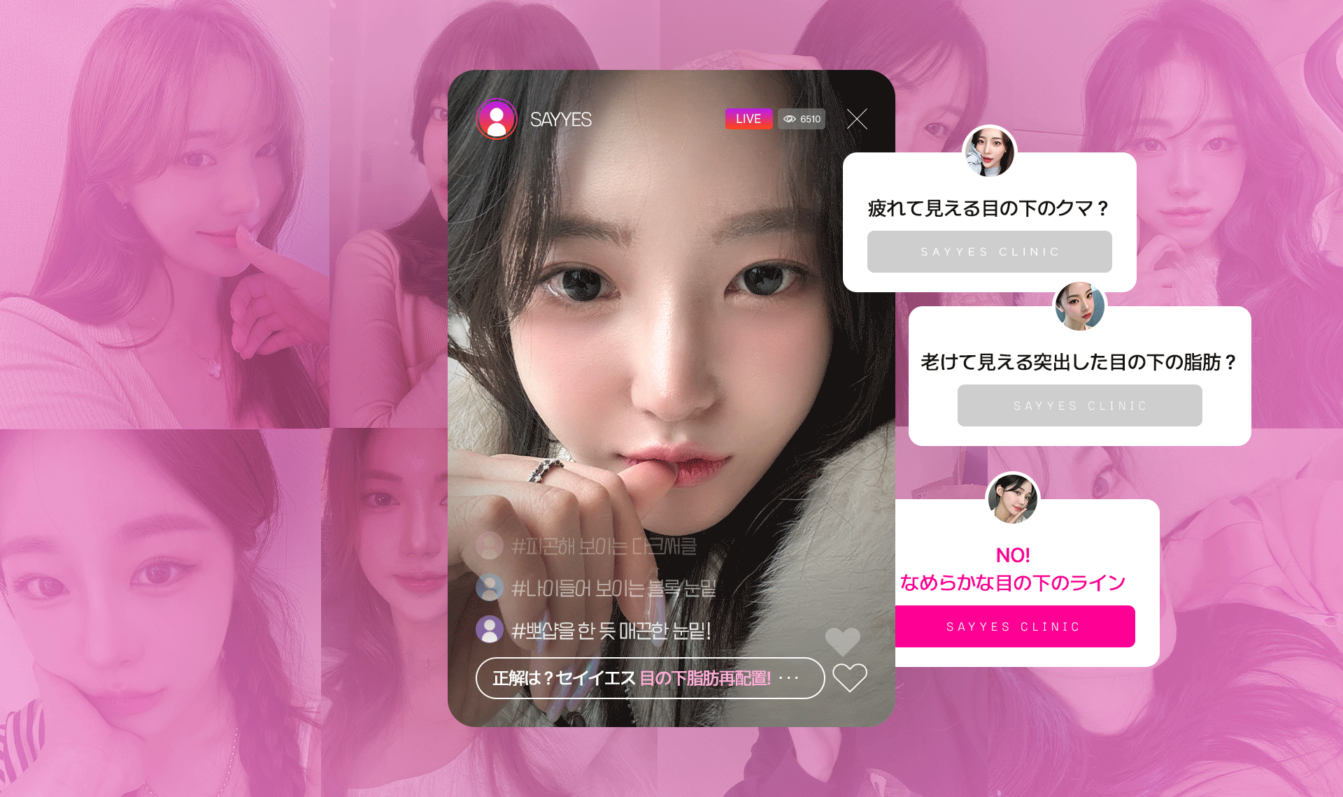 若々しい顔ラインは 目の下から始まる 目の下の脂肪 再配置 疲れて見える目の下のクマ？ 老けて見える突出した目の下の脂肪？ NO! なめらかな目の下のライン