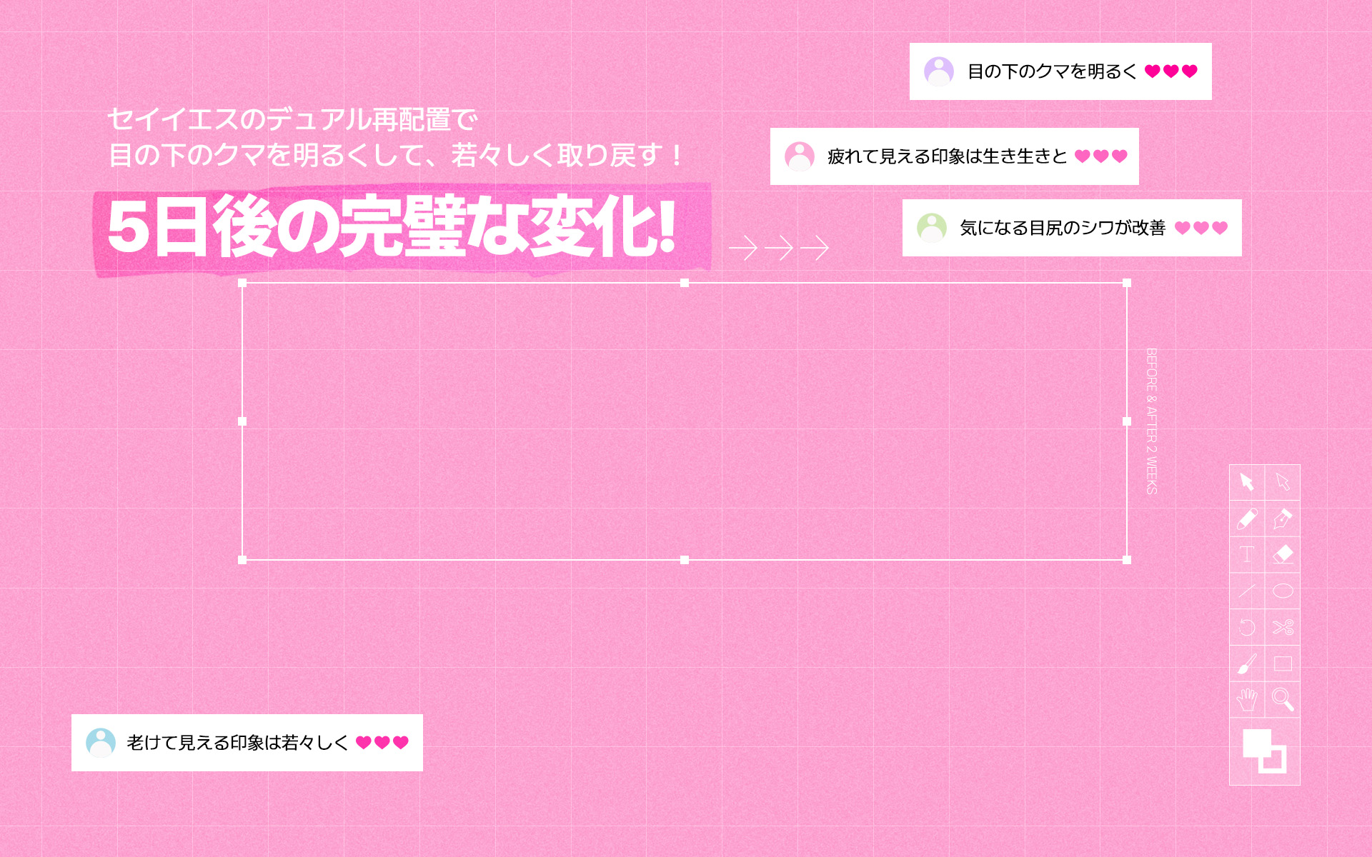 セイイエスのデュアル再配置で 目の下のクマを明るくして、若々しく取り戻す！ 5日後の完璧な変化！