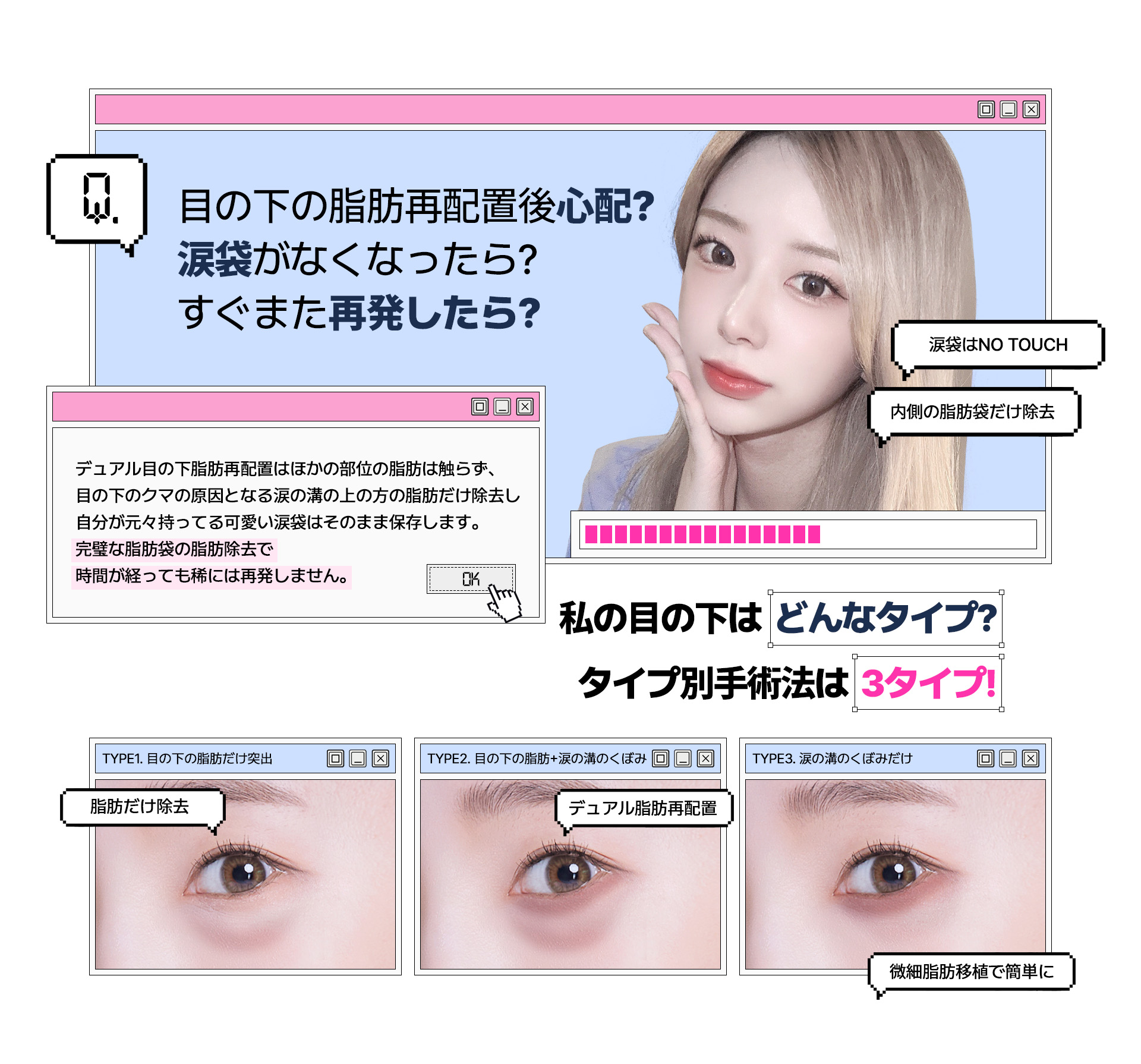 デュアル目の下脂肪再配置はほかの部位の脂肪は触らず、 目の下のクマの原因となる涙の溝の上の方の脂肪だけ除去し	自分が元々持ってる可愛い涙袋はそのまま保存します。	完璧な脂肪袋の脂肪除去で 時間が経っても稀には再発しません。