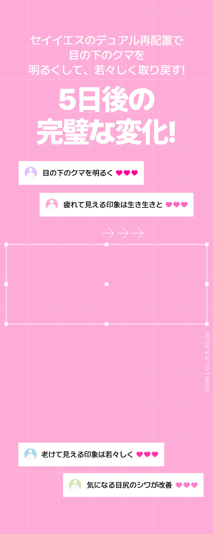 セイイエスのデュアル再配置で 目の下のクマを明るくして、若々しく取り戻す！ 5日後の完璧な変化！