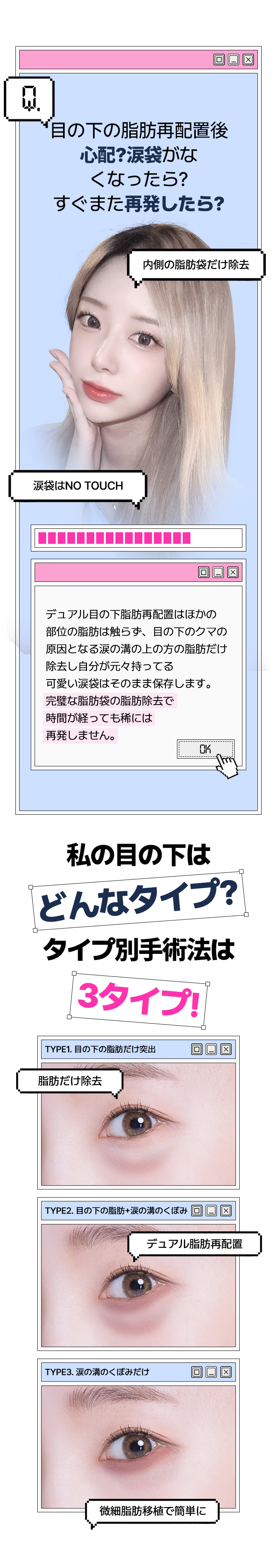 デュアル目の下脂肪再配置はほかの部位の脂肪は触らず、 目の下のクマの原因となる涙の溝の上の方の脂肪だけ除去し	自分が元々持ってる可愛い涙袋はそのまま保存します。	完璧な脂肪袋の脂肪除去で 時間が経っても稀には再発しません。
