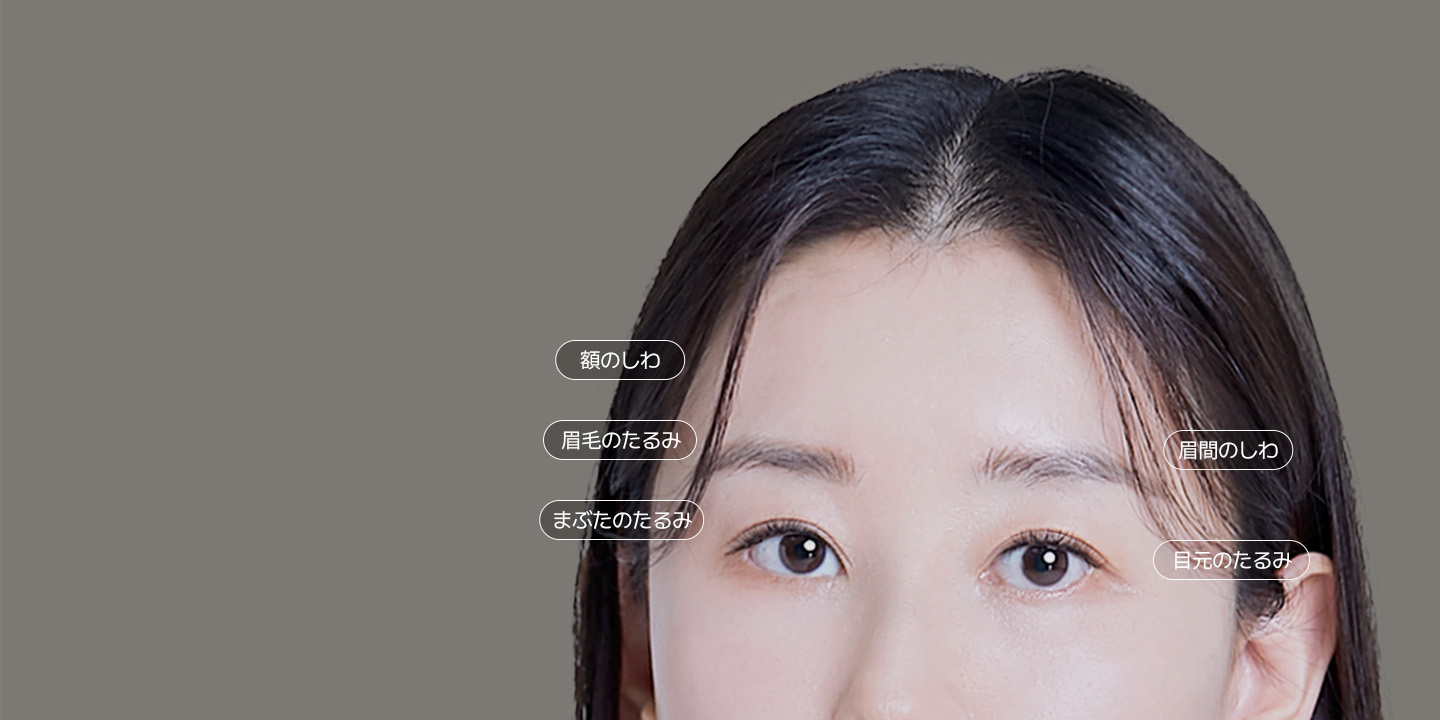 憂鬱に見える 老けて見える + 目元のたるみ + 眉毛のたるみ + 眉間 + 額のしわまで 同時に改善 内視鏡額リフト