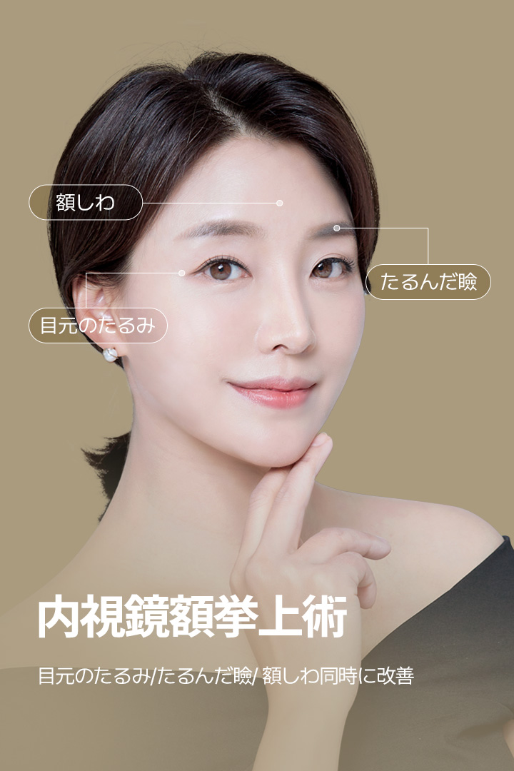 内視鏡額挙上術 目元のたるみ/たるんだ瞼/ 額しわ同時に改善 額しわ 目元のたるみ たるんだ瞼