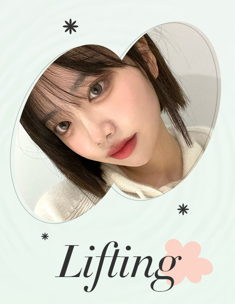 たるみ､弾力、ボリューム改善！セイイエスリフトイベント