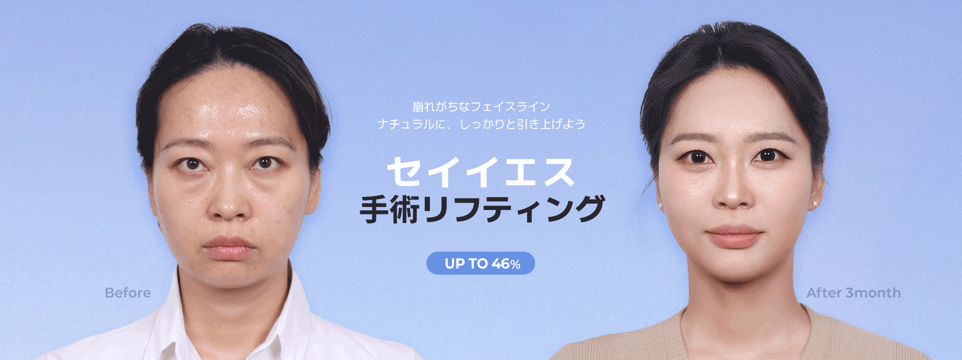 手術リフト