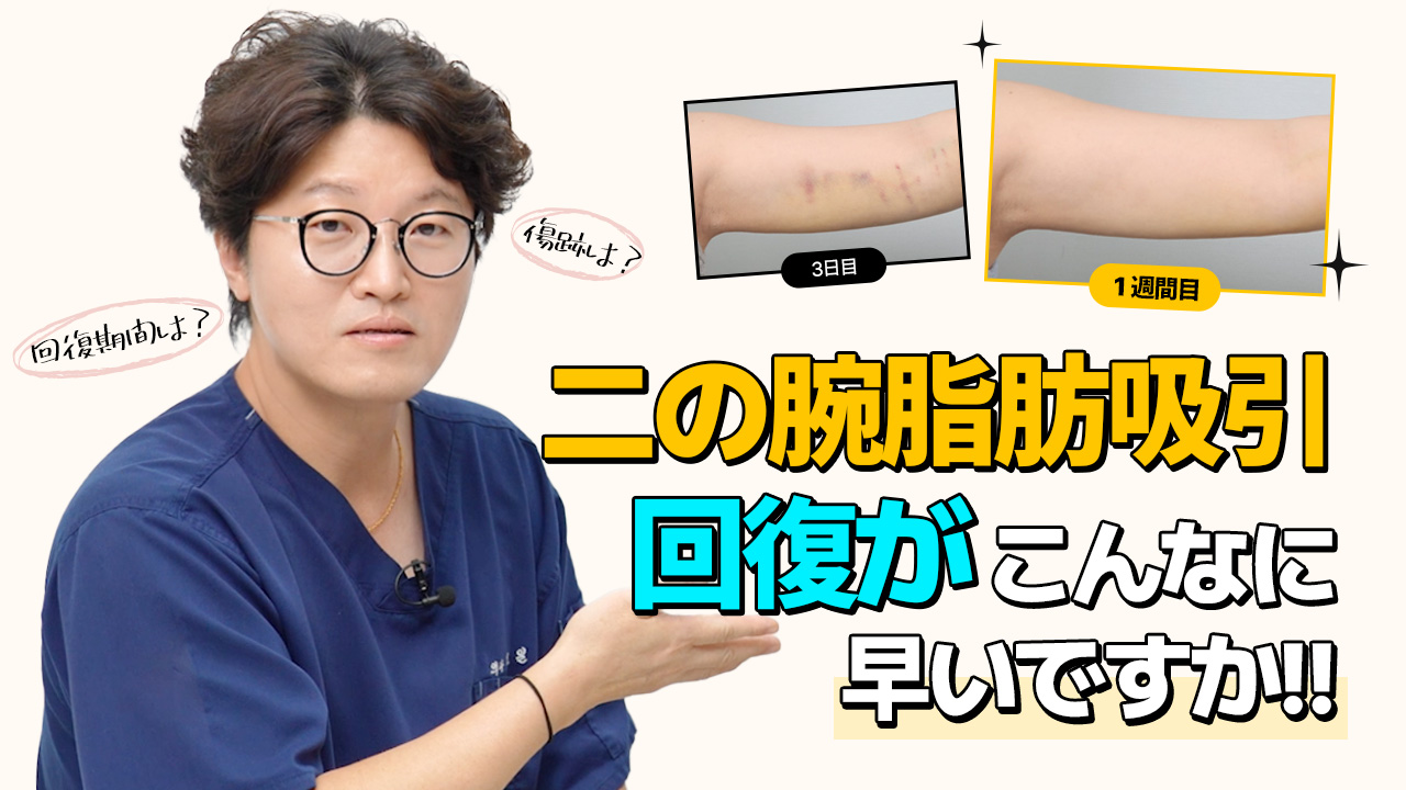 画像で見る最も多い、Q&A