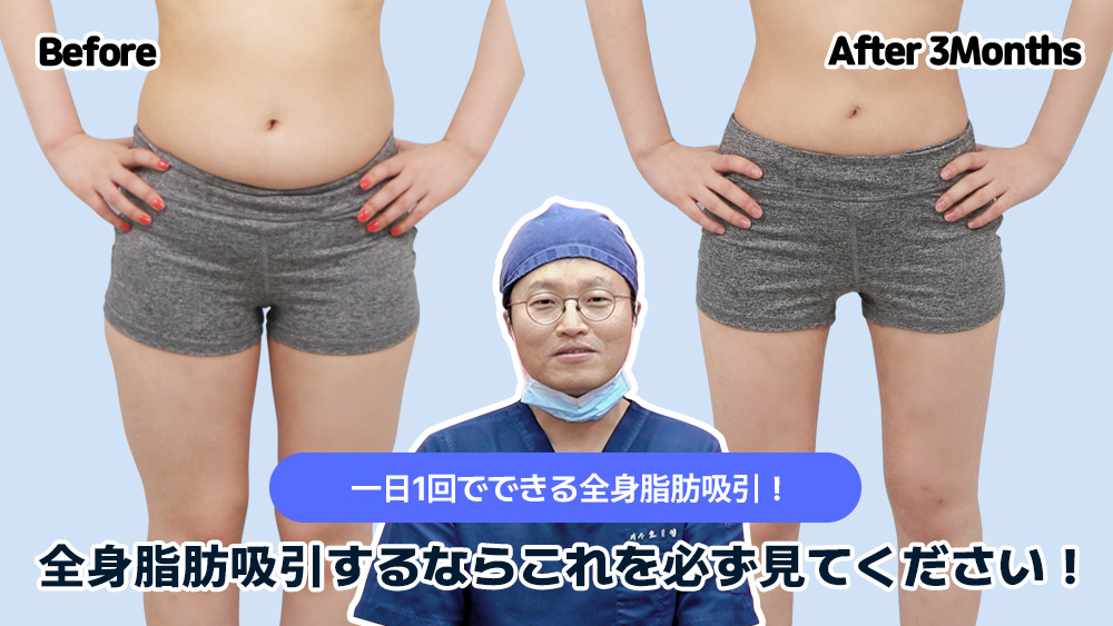 セイイエスとともに整形、Story