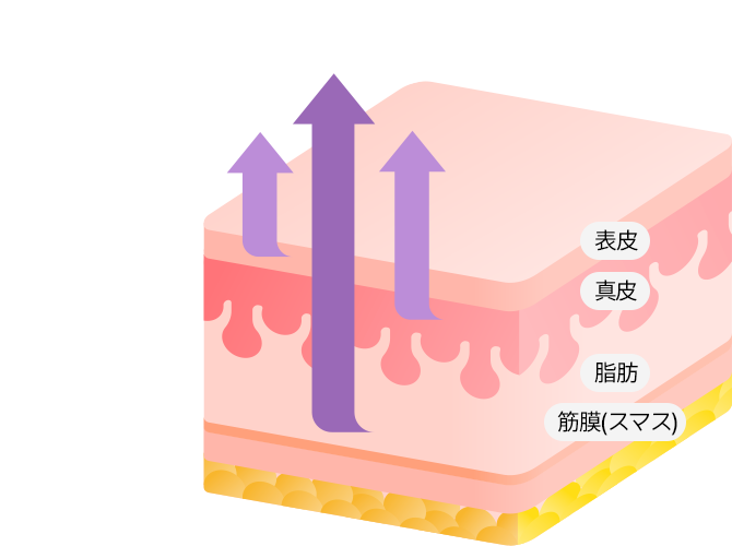 単純に皮膚だけを 引っ張るリフトNO! 表皮∙真皮∙スマス∙維持靭帯 4重に引っ張ってくれるセイイエス4Xミニリフト、 中のたるみからしっかり引き上げ効果UP!