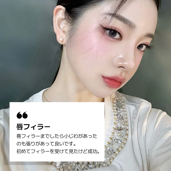 唇フィラー REVIEW