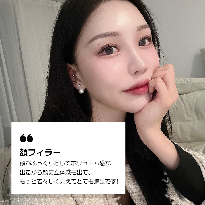 額フィラー REVIEW