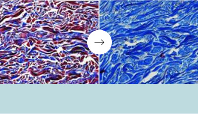 コラーゲン増加