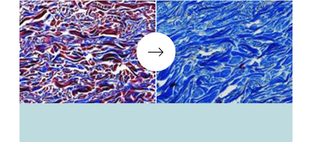 コラーゲン増加