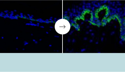 アンチエイジング