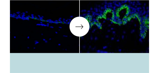 アンチエイジング