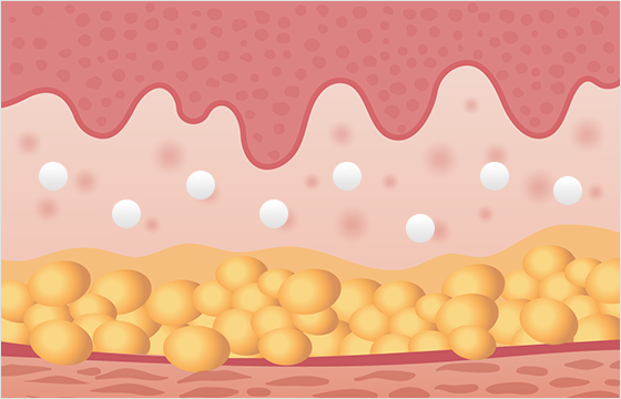 ウルトラコールを注入