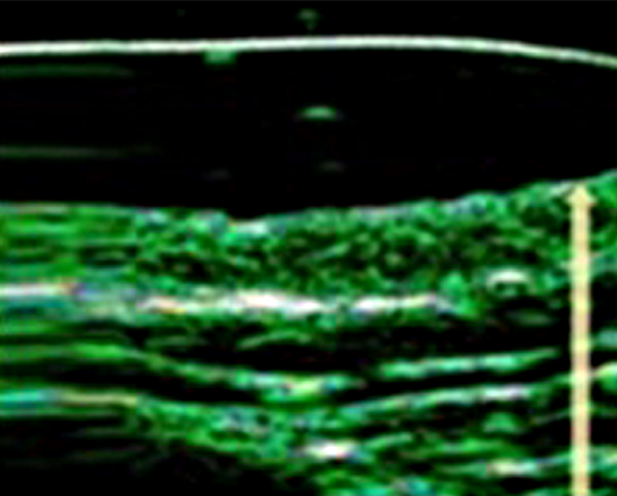 レディエッセの施術前