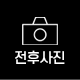 전후사진 링크