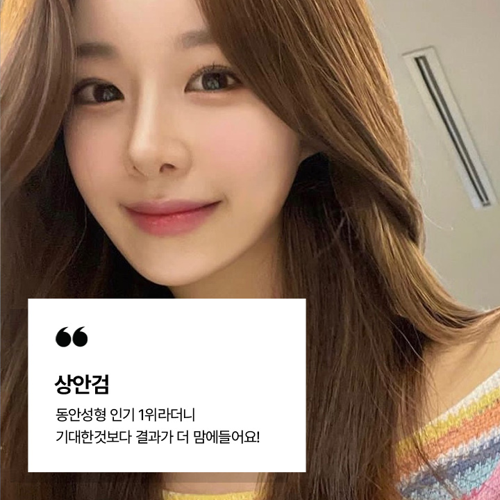 상안검 시술후기