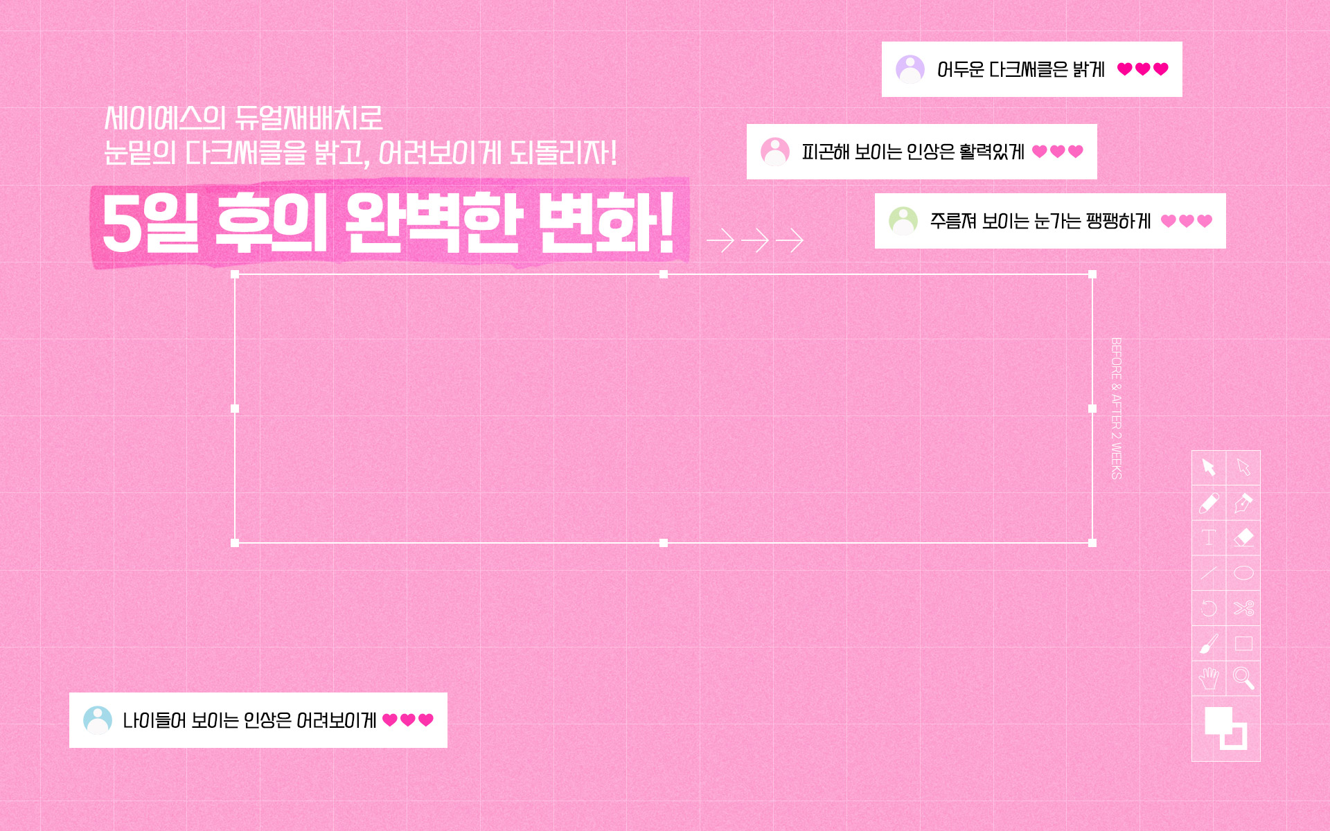 세이예스의 듀얼재배치로 눈밑의 다크써클을 밝고, 어려보이게 되돌리자! 5일 후의 완벽한 변화!