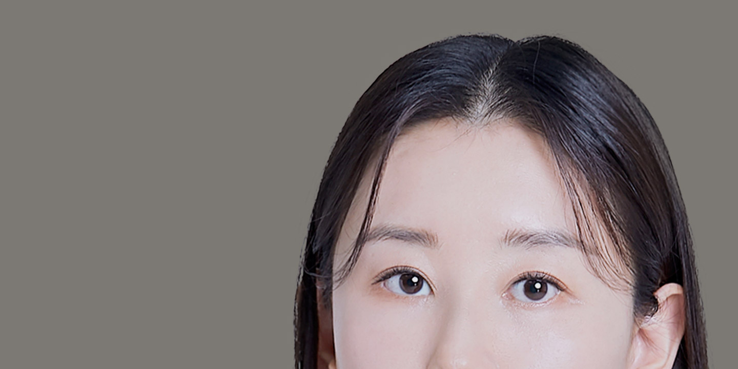 상안검 수술로 생기있어 보이고 어려지는 눈매! + 노화로 인한 처진 눈꺼풀 + 변형된 눈 모양 + 심한 눈꺼풀 처짐으로 답답한 인상 한 번에 개선! 상안검
