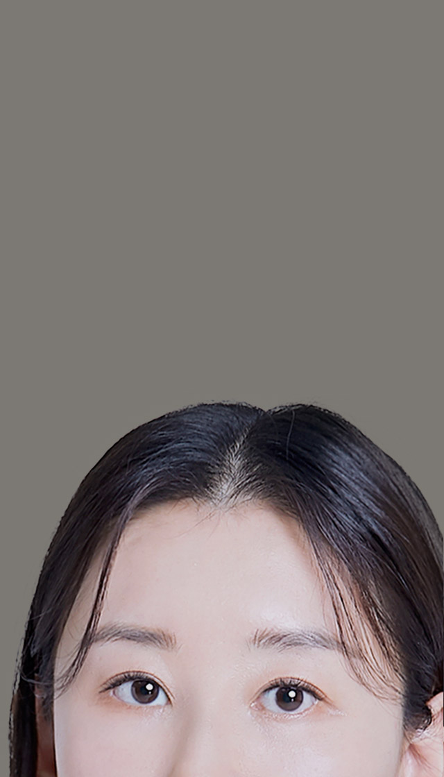 상안검 수술로 생기있어 보이고 어려지는 눈매! + 노화로 인한 처진 눈꺼풀 + 변형된 눈 모양 + 심한 눈꺼풀 처짐으로 답답한 인상 한 번에 개선! 상안검