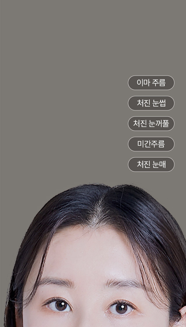 우울 해 보이고나이 들어 보이는 + 처진 눈매 + 처진 눈썹 + 미간 + 이마 주름까지 한 번에 개선 내시경 이마리프팅