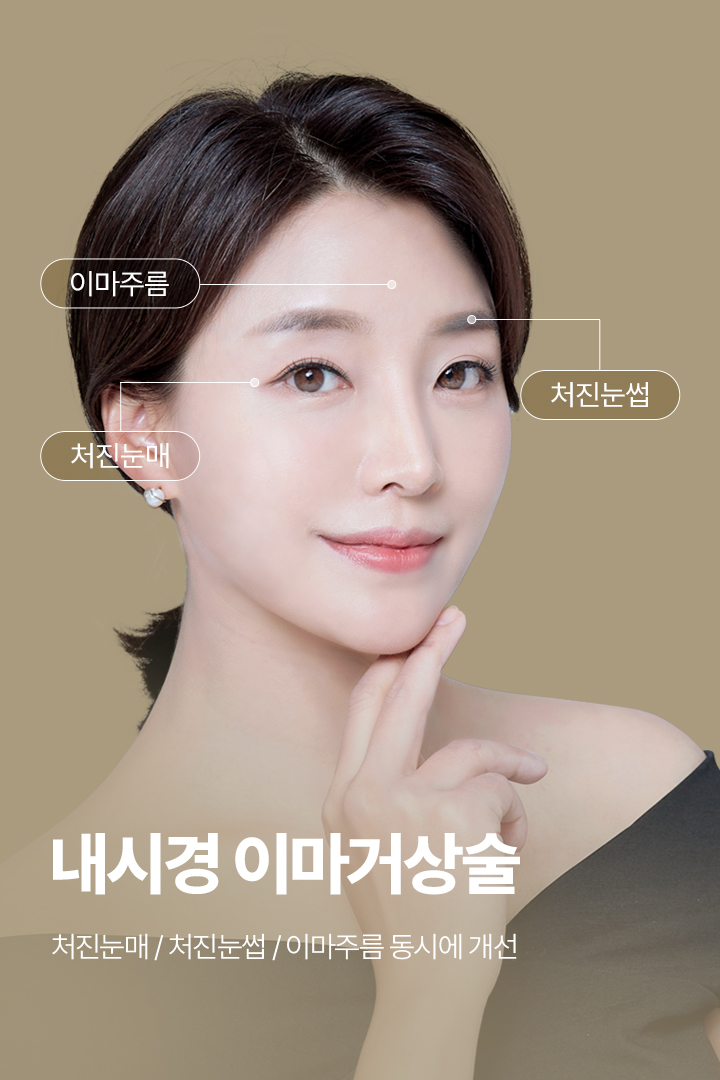 내시경 이마거상술 처진눈매 / 처진눈썹 / 이마주름 동시에 개선