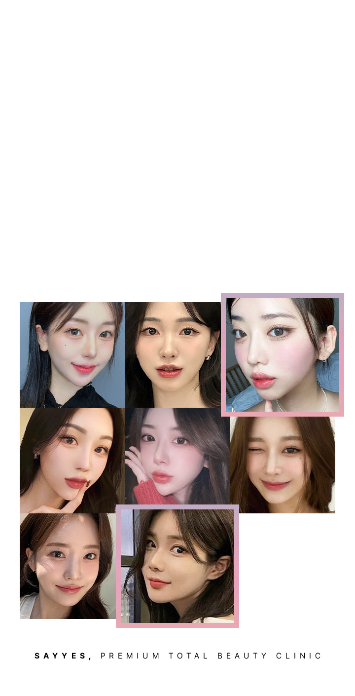 가장 빠른 효과를 볼수 있는 지방흡입은? 가장 시술 시간이 적은 지방흡입은? 뼈를 깎지 않고 얼굴이 작아지는 방법은?아큐V 얼굴축소 지방제거