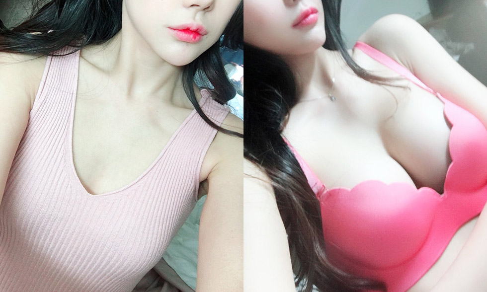 뽑은 지방이 아깝다면 뽑아서 넣어주는 물방울 가슴주사 팻브라 전후사진