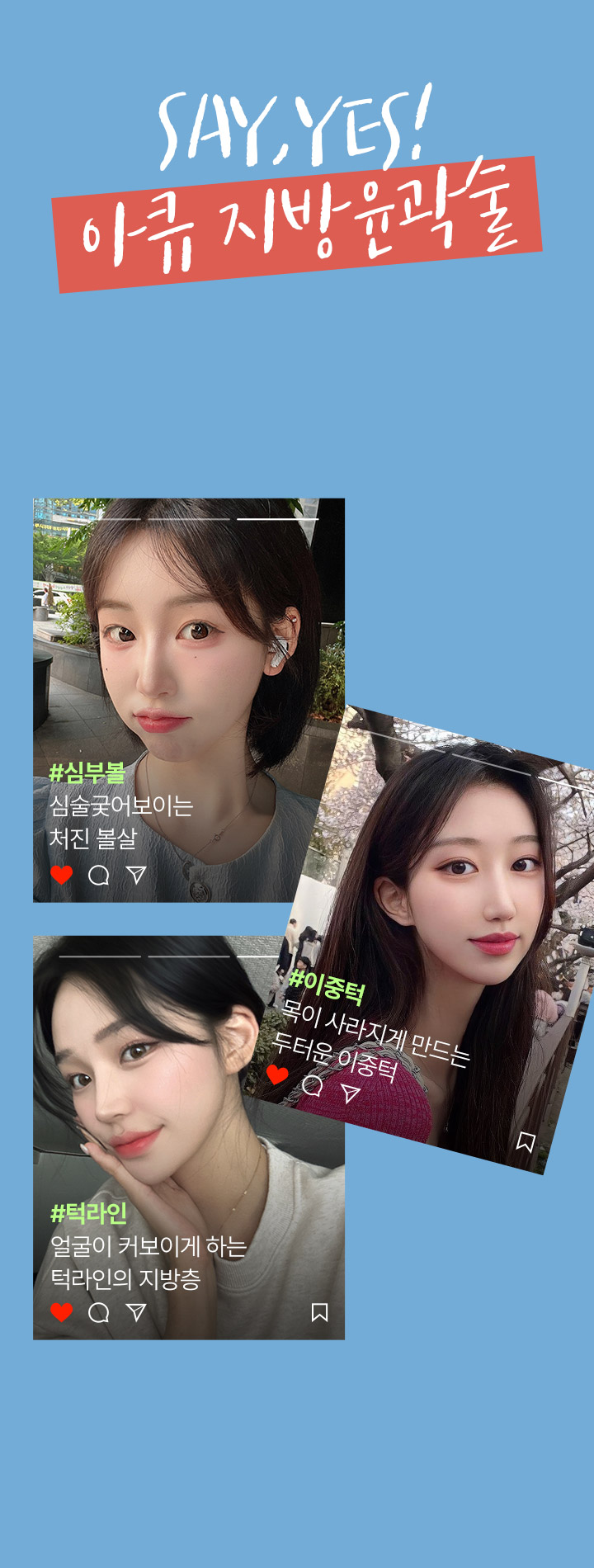 아큐 지방 윤곽술 최소 비용으로 바로 다이어트한 것 같은 효과! 심부볼, 이중턱, 턱라인 3부위 지방 동시 제거