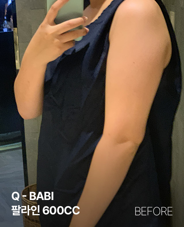 전후사진