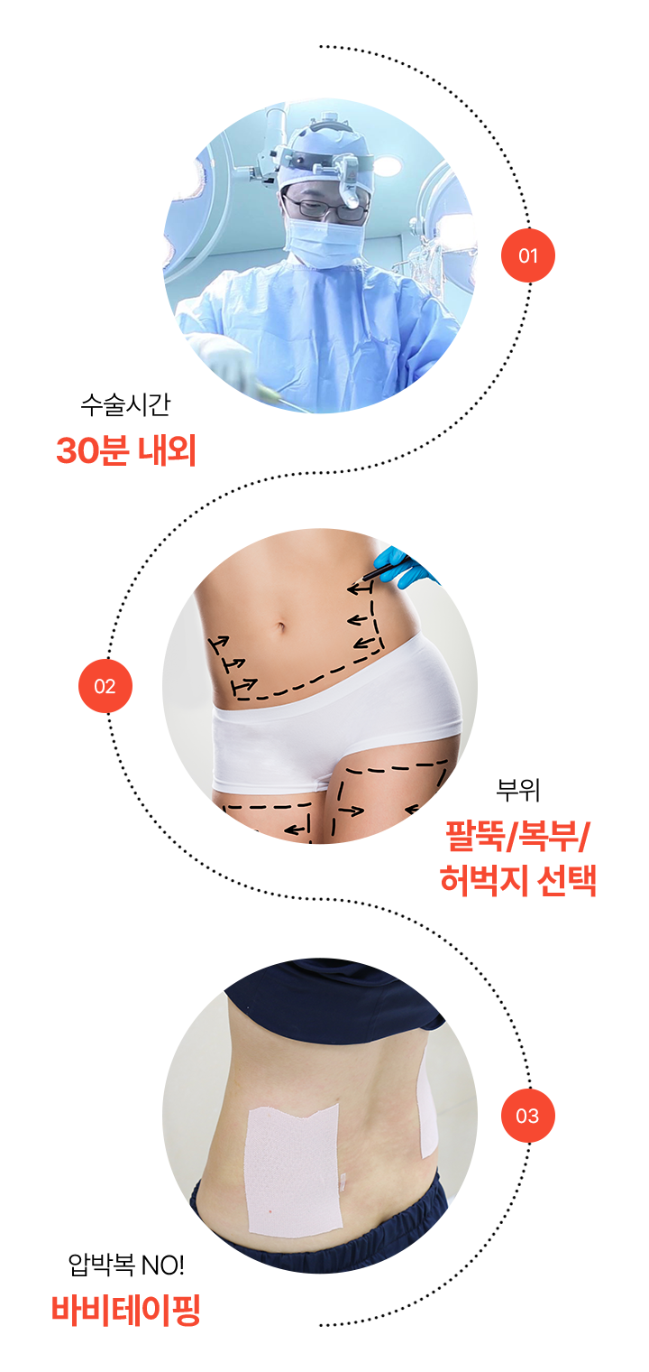 원하는 부위 골라 FULL로 뽑자 원더풀 지방흡입